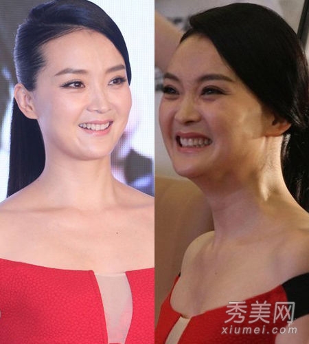 ����Ȧ�����緶������ޱ����Ů�Ƿ������ع�