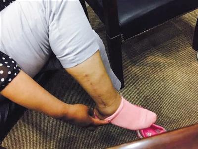 �˿���߷�����λˤ�� ��С�ȹ���