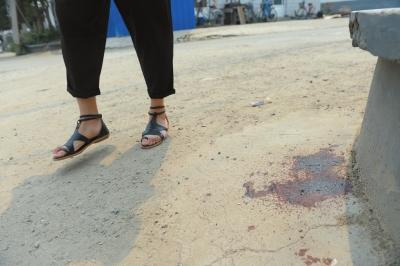 �ֵܵܳ����׸�Ҽ��˾Ϳ� ��3��סԺ