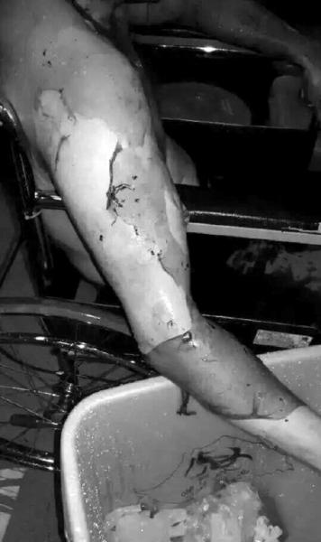 ҽ���������Ͳ���ȼ �����