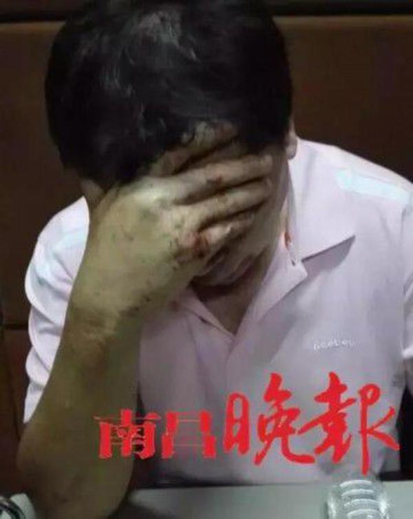 ����������Ͷ�ʹ�Ʊ����Ǯ������ɱ��