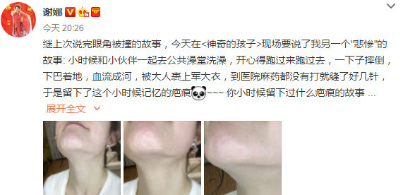 л��ɹ�°Ͱ̺��� ��˵����ʱ��Ѫ���ɺ�