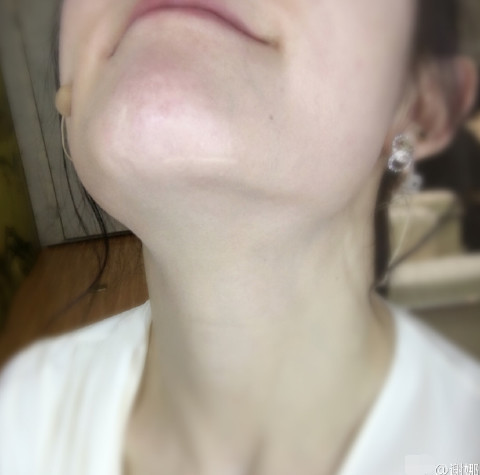 л��ɹ�°Ͱ̺��� ��˵����ʱ��Ѫ���ɺ�