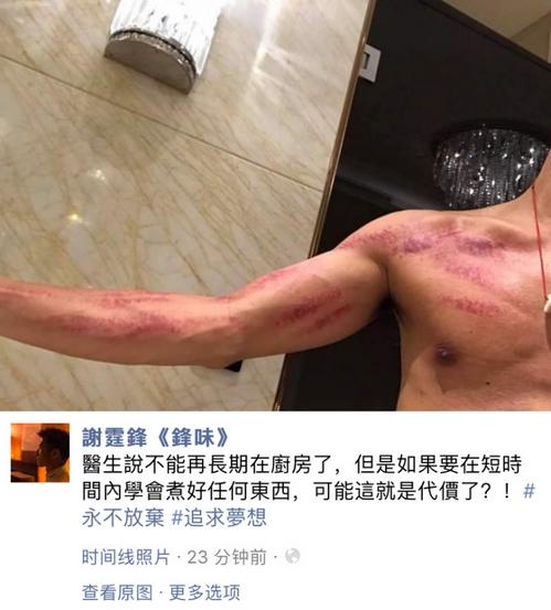 л��������ֱ��������� ȫ����Ϊ�������̫ƴ