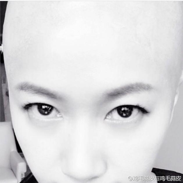 �쾲��΢��ɹ��ͷ������������