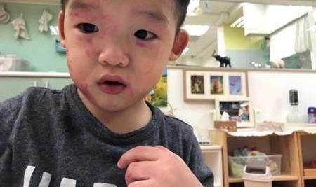 ������ɹ��˫��̥���ӣ�����п������裬��Ҫһ��ǿ�����