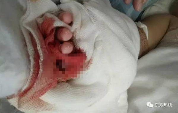 ��������Ӥ����ҽ���������ָ �ҳ�����ҽ��Ϊħ��