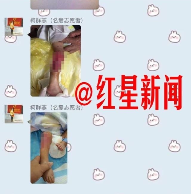 ��֣�31���˱������ҧ��Ӥ����δ�������������˿ڿ�����