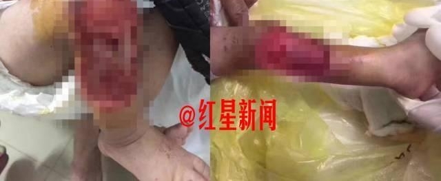 ��֣�31���˱������ҧ��Ӥ����δ�������������˿ڿ�����