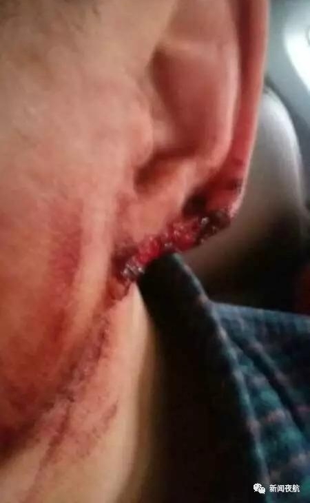������������������ �ھ���������δ����ҧ������
