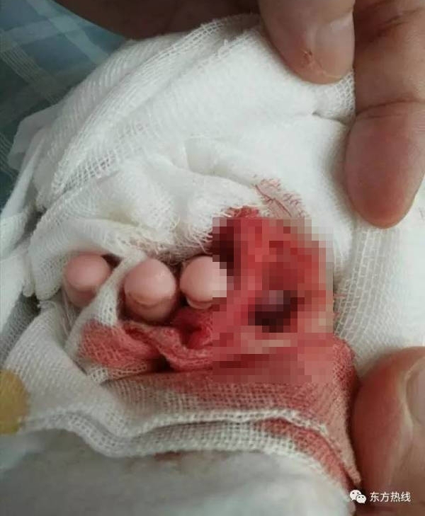 ��������Ӥ����ҽ���������ָ �ҳ�����ҽ��Ϊħ��