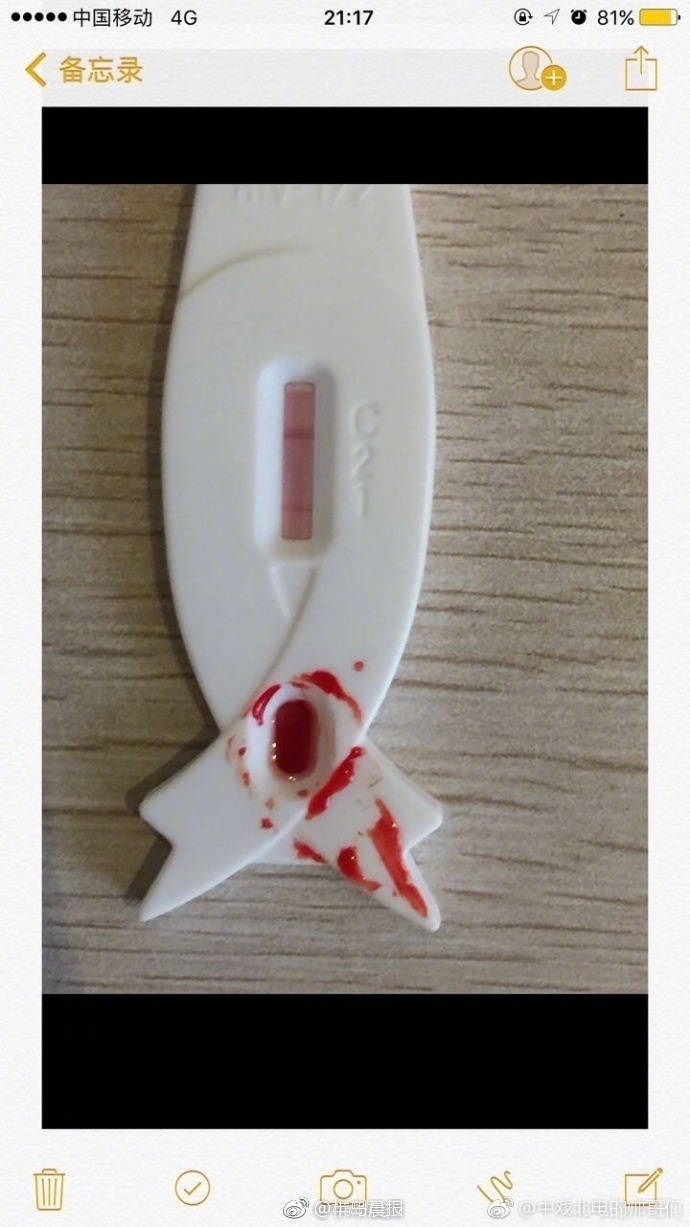 �㴫һ������ָ��֪��ȾHIV �Ժ����˷�����������Ϊ