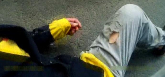 ������綯��ˤ����ͷ��Ѫ ��:����������