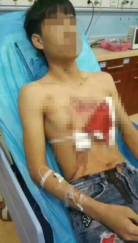 �������������гֻ�ҩǹ������ɨ�� �����ز���ǹ