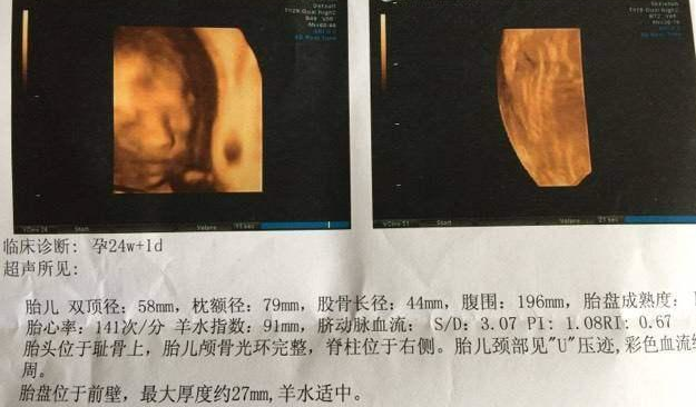 ֪���һ���Ů�������Ŷٶ��̲ˣ�����2300�������������