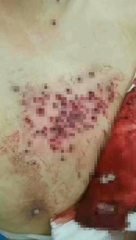 �������������гֻ�ҩǹ������ɨ�� �����ز���ǹ