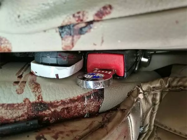 Ѫ�Ľ�ѵ��������ﳵ������ ���֡������ۡ�������