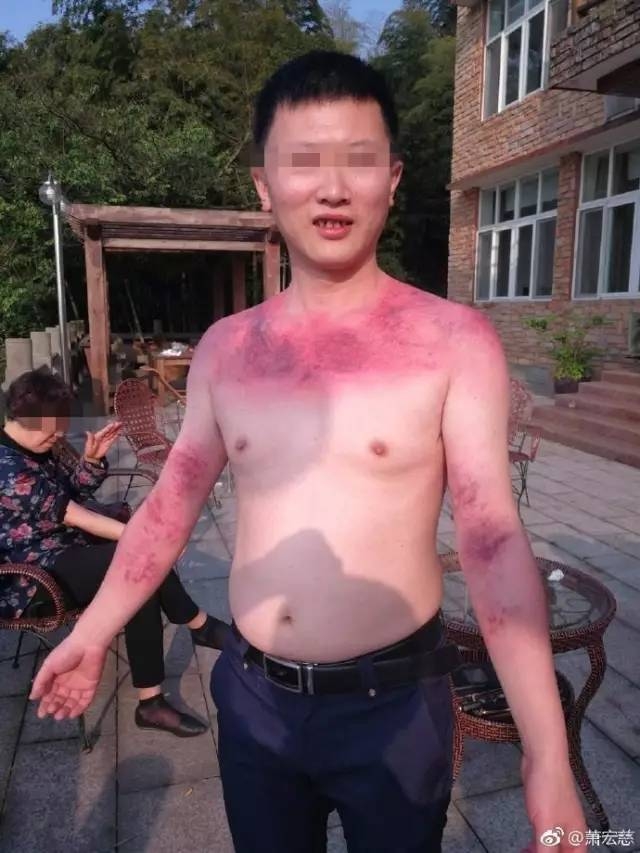 ����7��С���� ���Ĵ�������ҽ����ץ ��˿����ͦ