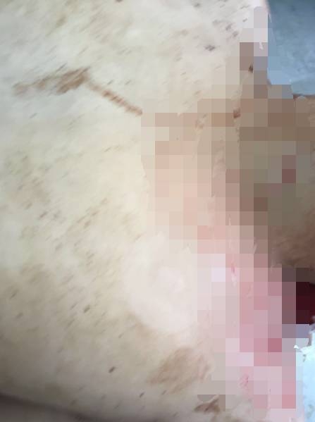 ����һ��������˯�б�����ɱ��