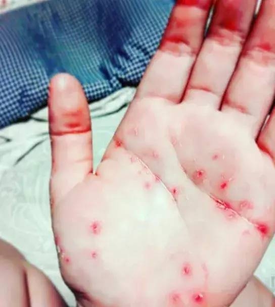 ���Ŷ��ۣ�Σ����Ϸ��������塱���� ���������ģ��