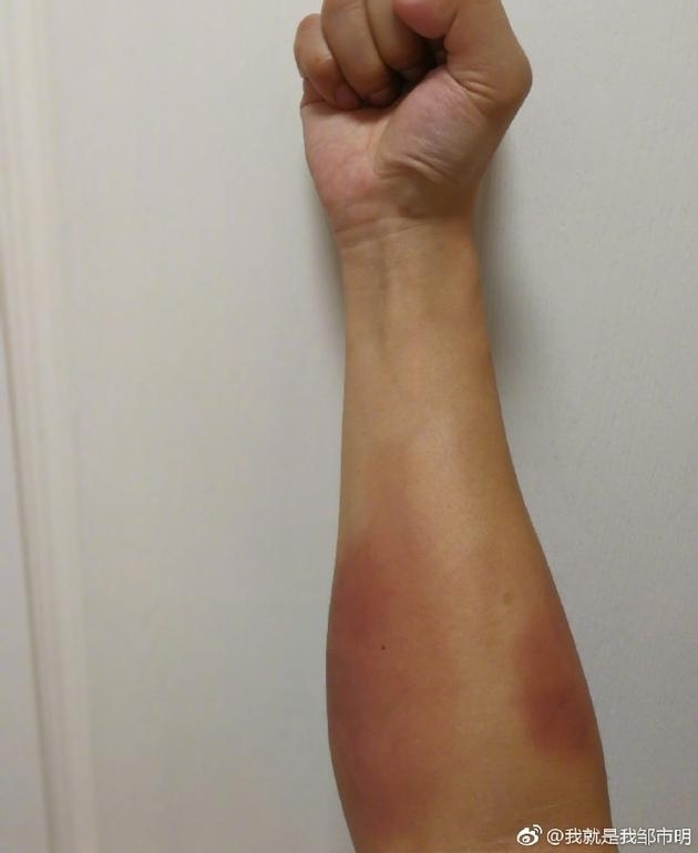 ��ů�ģ�������ѵ���ֱ����� �������������ñ���