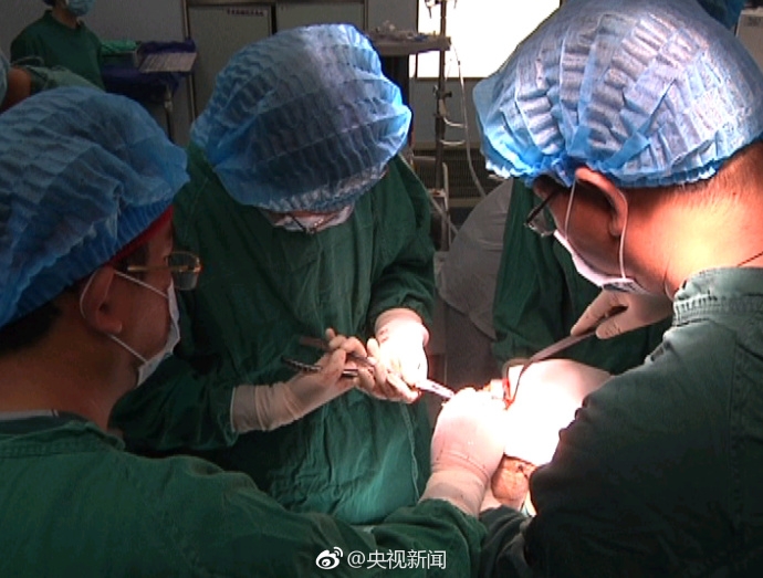 ����һ90��Ѫ�Ѳ����߳ɹ��û�3D��ӡϥ�ؽ�