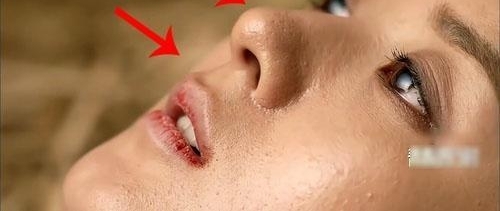 ���Ǵ�����ӱ����Ƥ��״̬����ѣ��۴̺�ͷ��ע��Ƥ��������