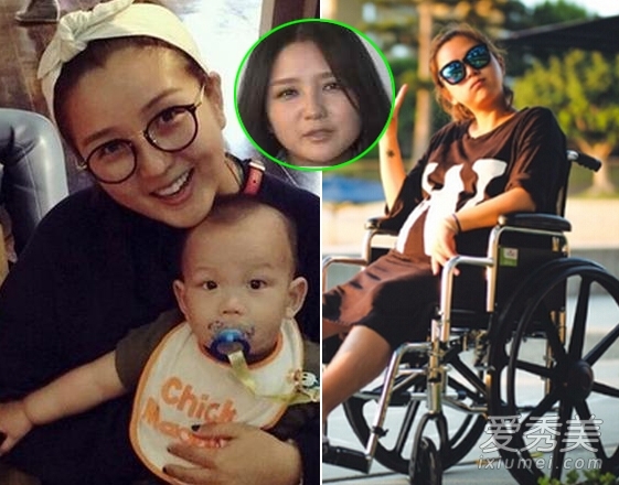 何洁怀孕脸肿胳膊肿丑哭 盘点女星孕期最丑照片