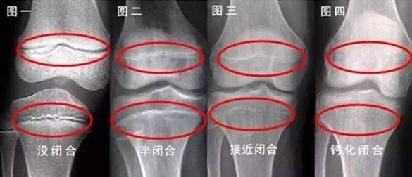 14���к�3��û���� �ְ�ȴ˵������4�׷� ��������