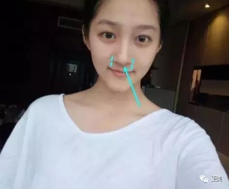 ����ͮ���ȡ����ʵ��ۡ�������Ļ�Ѫ����95��С������Ҫ�����ݡ�baby��������Ȧ��