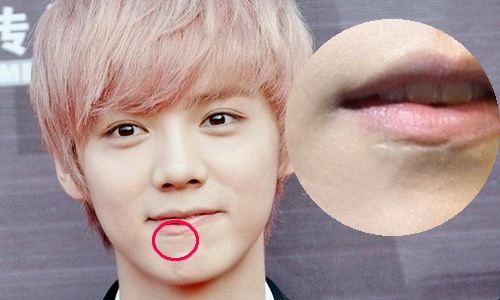 鹿晗脸上有道疤你能看到吗 竟系EXO内讧被吴亦凡痛殴留下