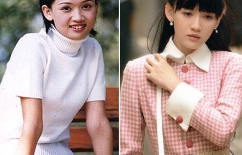 38岁陈乔恩整容失败?下巴变尖,脸部僵硬浮肿