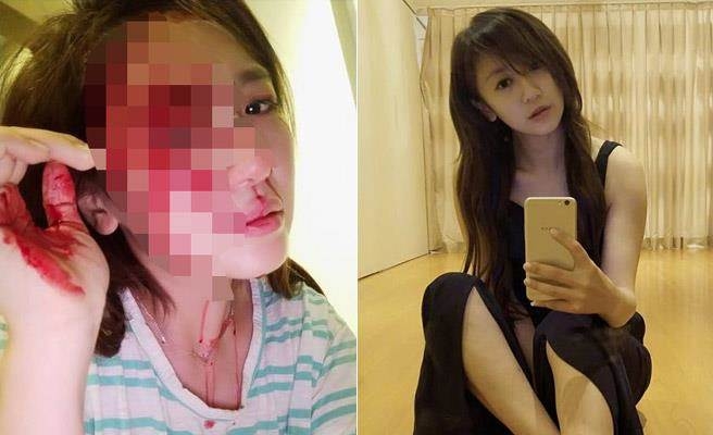 被砸得头破血流 她第一反应竟是上传自拍…