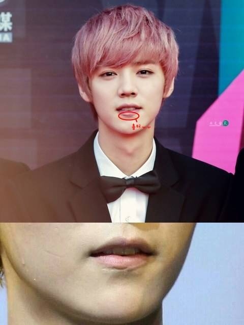 鹿晗脸上有道疤你能看到吗 竟系EXO内讧被吴亦凡痛殴留下