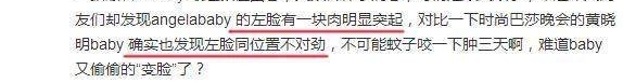 Angelababy新造型撞脸郑爽,左脸被发现肿起一块小包