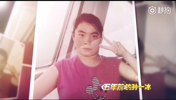 长得丑遭老师羞辱“脑子被狗吃了” 她崩溃整容13次