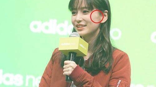 Angelababy新造型撞脸郑爽,左脸被发现肿起一块小包