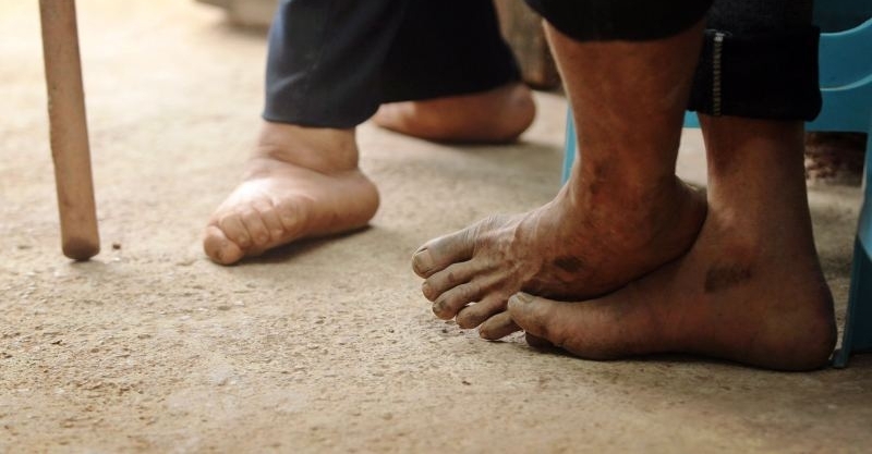 六旬老人背妻29年:一个没有视力 一个走路不好