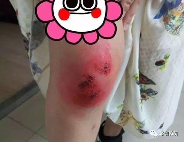�ֲ�����ҹ�����Ů��ʿͻȻ��һֻ���ִӸߴ����£����������������˶�ŭ�ˡ���
