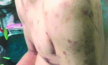 台一恶老板把员工当人体烟灰缸 事后还敲诈60万