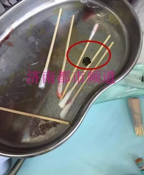 1���б�ʳ���ջ�2��Ů������̱����ֻ������ⶫ����
