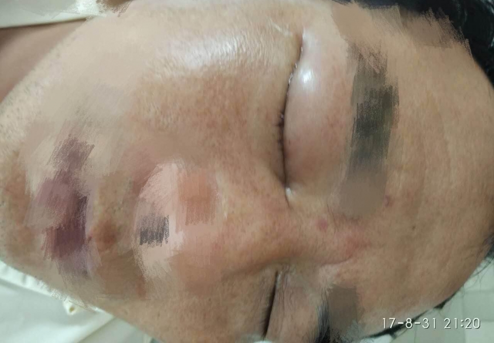 �۾���������Һ���������������������ʧ�����գ�