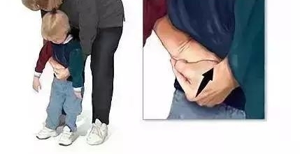 女童喝酸奶窒息护士抱她狂奔跑赢死神,儿童呛奶、异物卡喉这样做