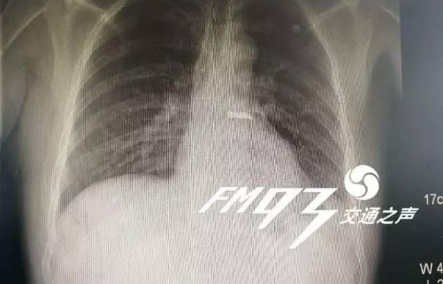���ӵ���ֱ������������ ����������˰��ָ�׸Ǿ���