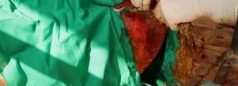 ������ţ�����쳣�״󣬽�����ҽ��飬���������������һĻ