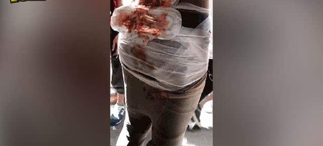 ���ǻ��֣��������ɱ���Ƹ��Ϸű��� ƨ��ը����