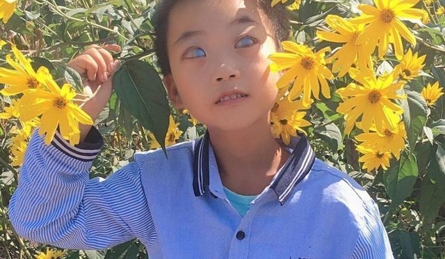 8岁“鬼眼”少年刘云峰,看到他的经历让人流泪!