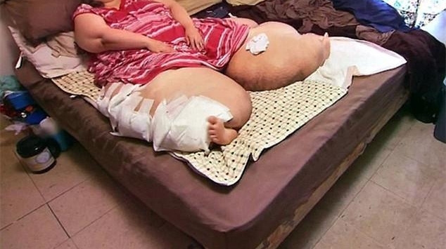 Ů������550����Ⱦ��ش�360��ϲ�����Ҫ���Сʱ��