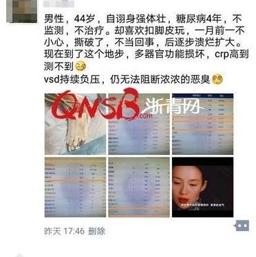 ���˴ν�Ƥ��44�������ҽŷ���������������֫�����������ˡ���