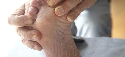 ���˴ν�Ƥ��44�������ҽŷ���������������֫�����������ˡ���